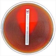 MTS� (MIC Test Strip)